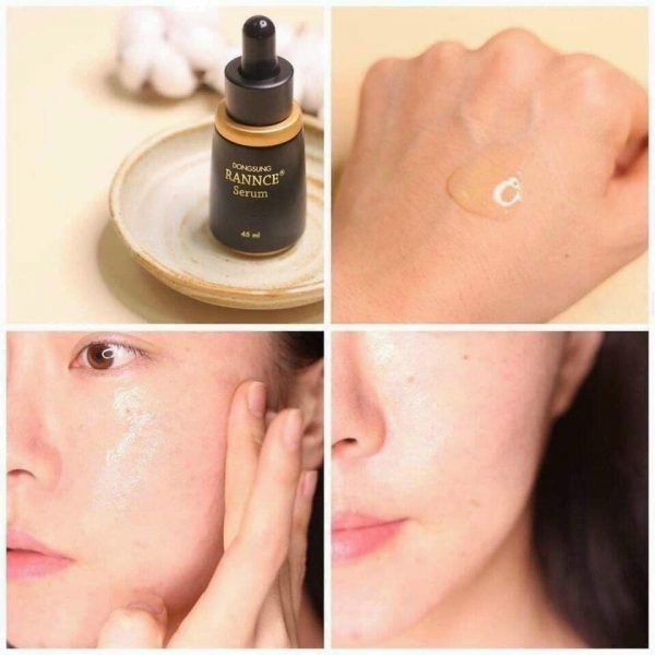 Serum Nám Dongsung Rannce Serum - 45ml