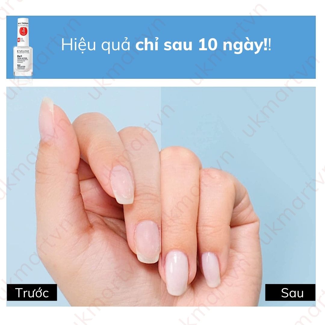 Sơn Dưỡng Móng Eveline 8w1 Total Action 12ml