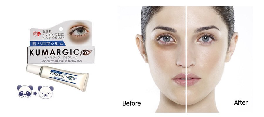 KEM TRi THÂM QUẦNG MẮT KUMARGIC EYE