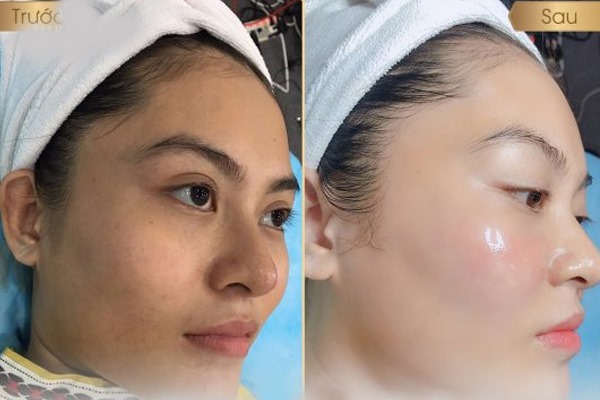 Kem Ủ Trắng Thải Độc Da Femmiu