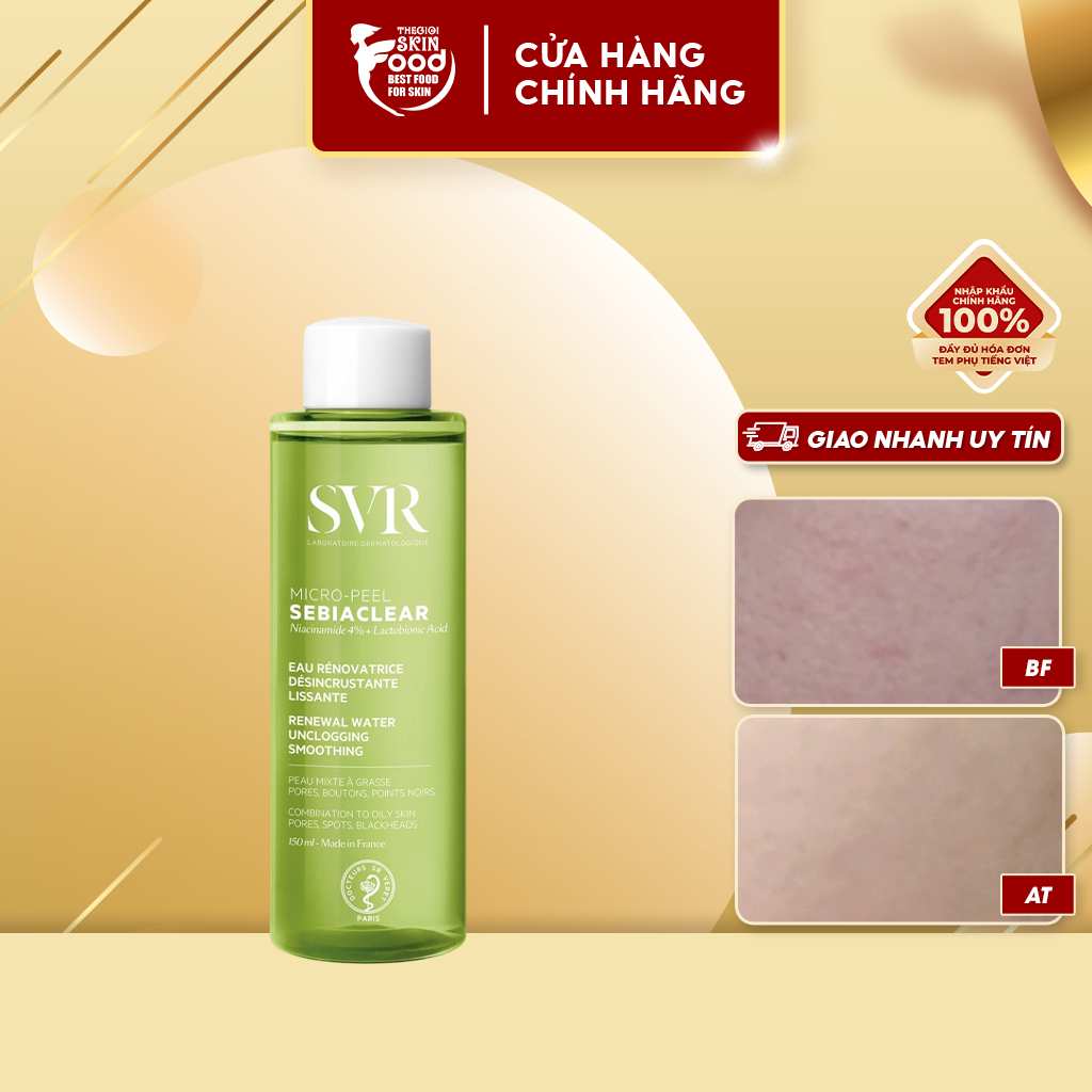 Nước hoa hồng cân bằng da dành cho da dầu mụn svr sebiaclear micro peel 150ml