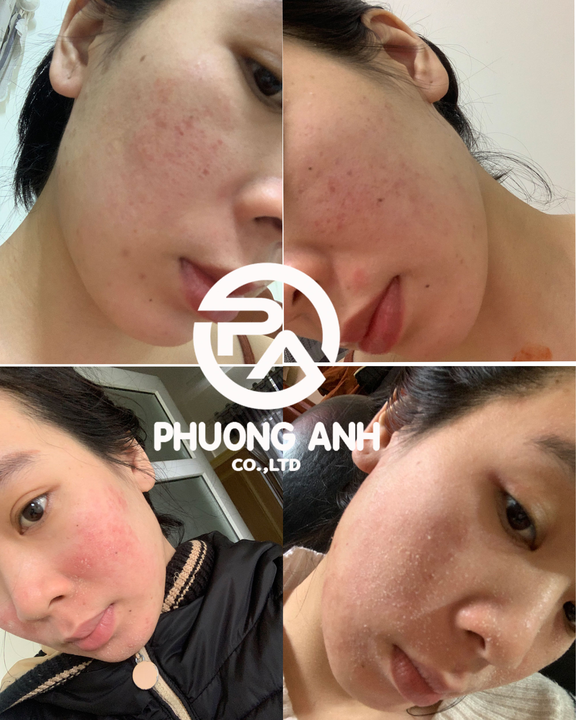 Kem sâm lạnh tái tạo da vip 20g