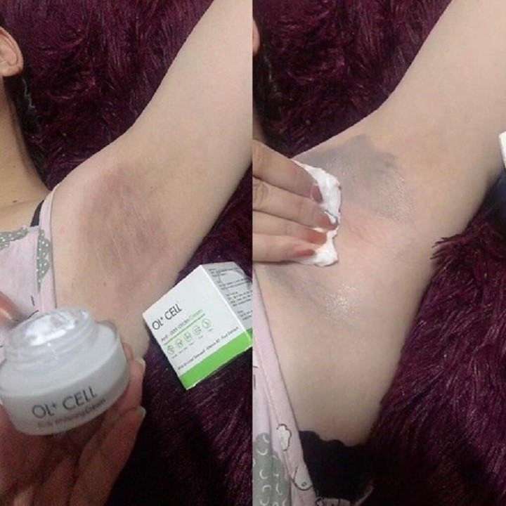 [HCM][ CHÍNH HÃNG ] Kem Trị Thâm Nách Thâm Môi Thâm Đầu Gối OL-CELL