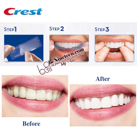 [SẴN, BILL MỸ] Miếng Dán Trắng Răng Crest 3D Whitestrips Glamorous White/Professional/Charcoal Mint [beNinetene]