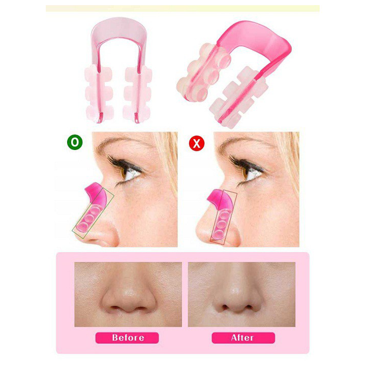 [HCM] Dụng cụ kẹp nâng mũi Nose up