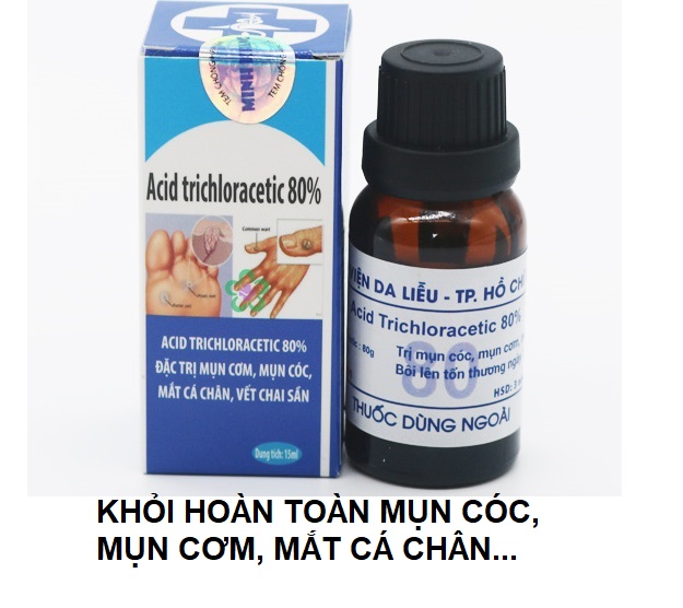 Mụn Cơm Mụn Cóc Mắt Cá Chân Vết Chai Sần