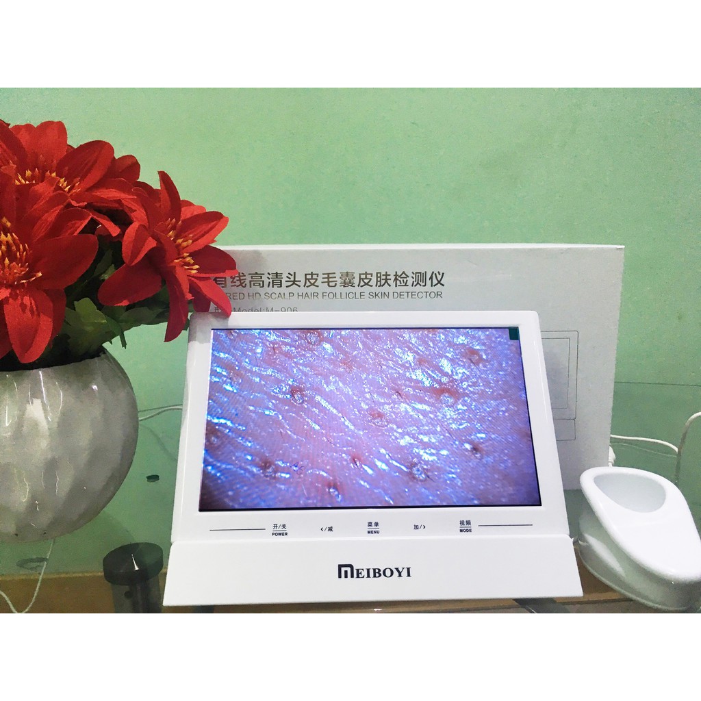 Máy soi da màn hình 10 inch nhỏ gọn cho spa