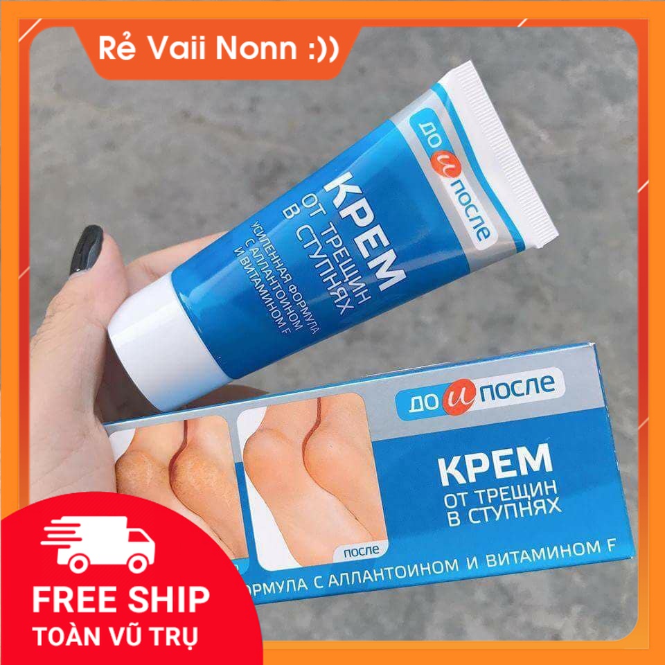 Kem Nứt Gót Chân Kpem Apteka 50ml Nga Giảm Nứt Gót Chân , Giữ Ẩm Da , Nhanh Kéo Da Non Gót Chân