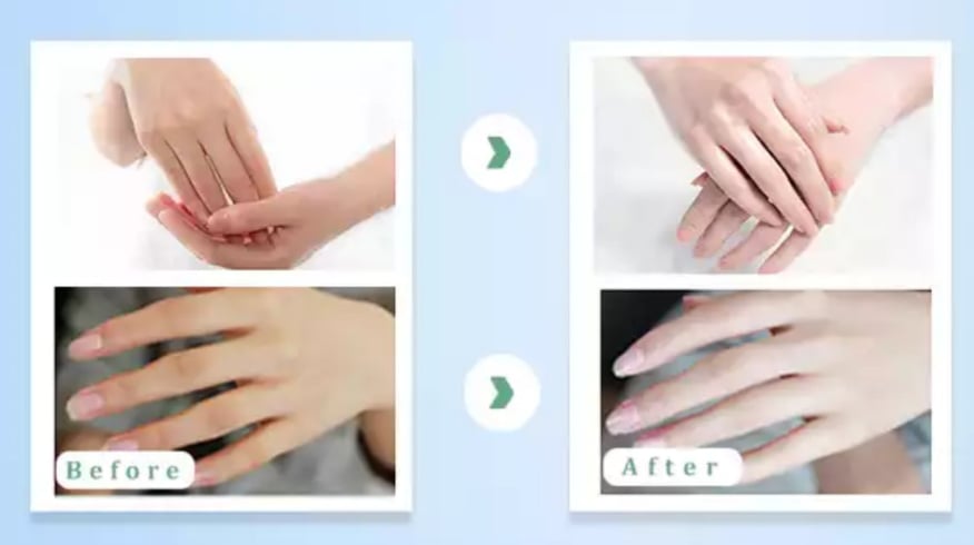 mặt nạ dưỡng ẩm tay dài