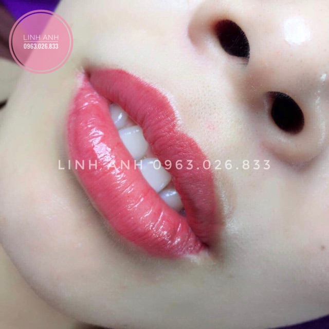 Tế bào gốc Pháp Bornface Stem Cell Solution