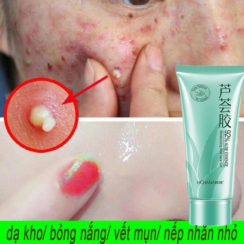 Gel lô hội hoàn hảo tự nhiên cân bằng dầu-nước cho da, loại bỏ mụn và vết mụn dành cho da nhạy cảm Ultra Fine Scrub Sensitive Skin 40ml