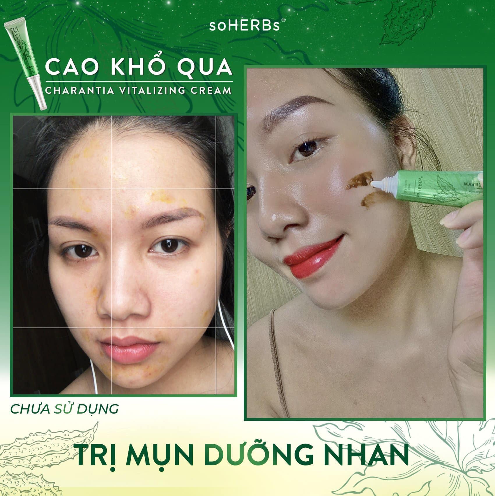 Cao Khổ Qua Giảm Mụn Soherbs Charantia Vitalizing Cream