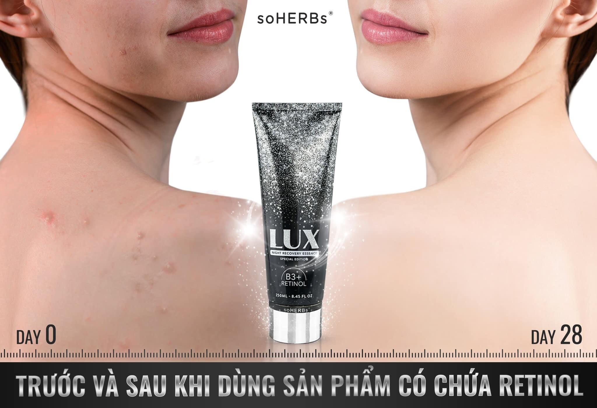 KEM TRẮNG DA DƯỠNG ẨM  BODY LUX SOHERBS