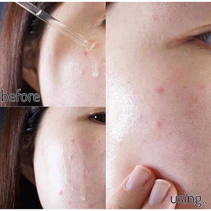 [NEW] SERUM B5 GOODNDOC HYDRA CHÍNH HÃNG
