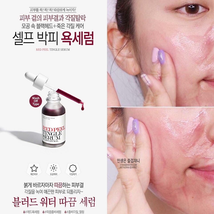 [HCM]THAY DA SINH HỌC RED PEEL HÀN QUỐC 35ml