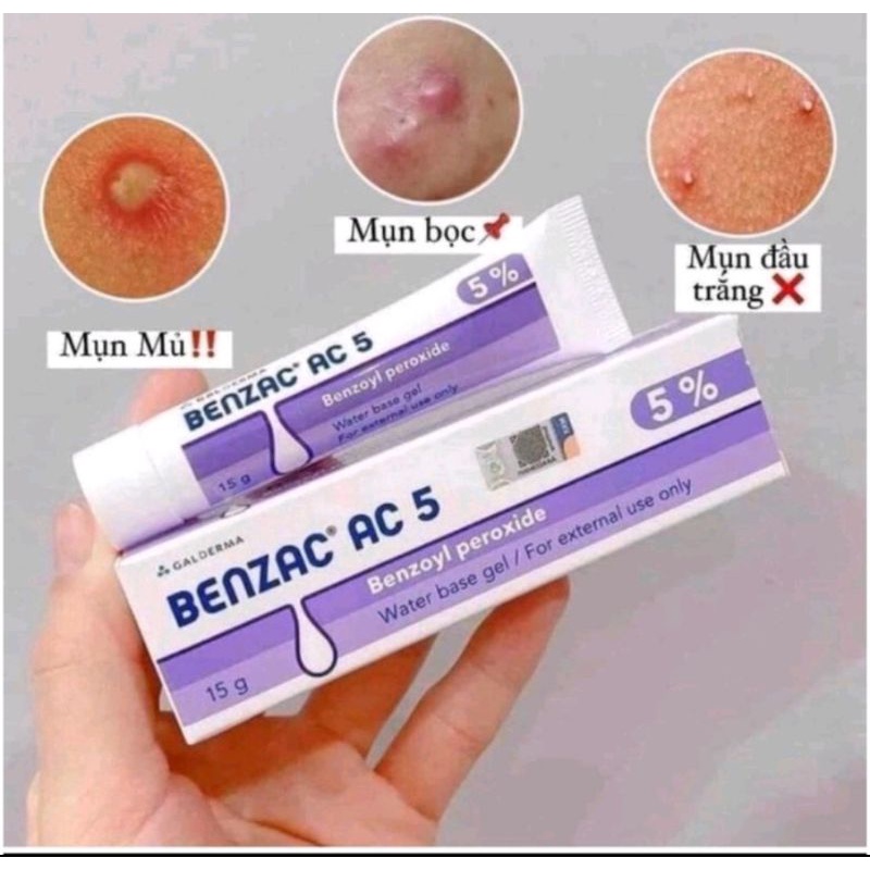[15Gam]Kem Giảm Mụn - Benzac Ac 5 5% 15G