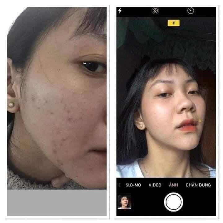 [HCM]Sữa Rửa Mặt Trà Xanh Hoa Đào