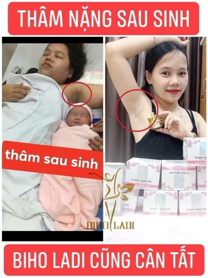 siêu dưỡng thâm vùng nách bụng bikini biholadi5s