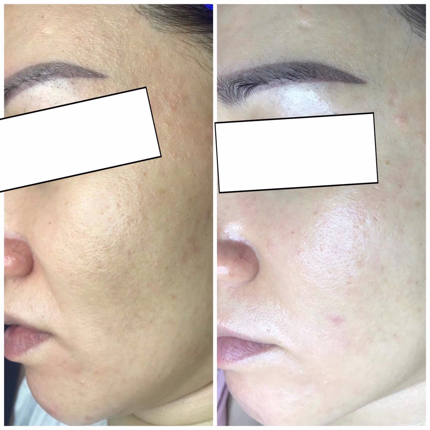 [HCM]Kem Dưỡng Trắng Da Tuyết Sứ EVAM