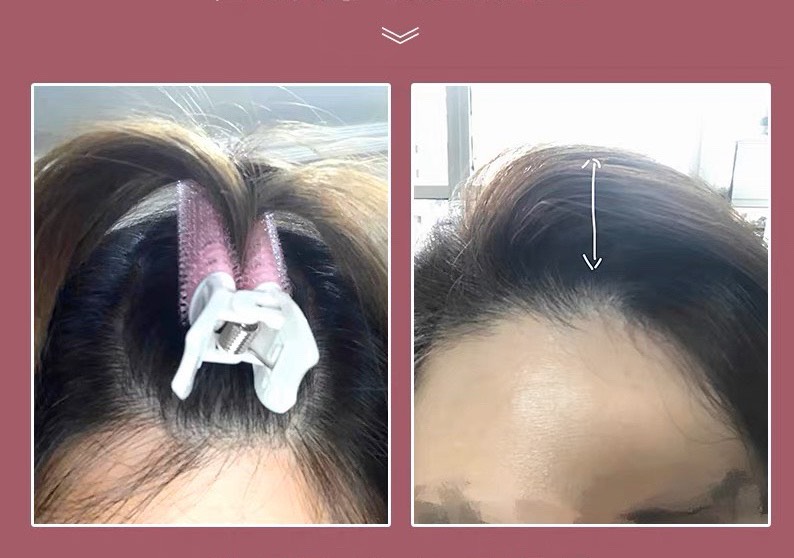 Lô kẹp phồng Tóc mái