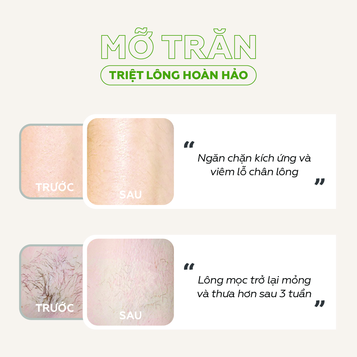 Mỡ trăn triệt lông vĩnh viễn U Minh Hạ nguyên chất 30ml | Mỡ trăn dùng cho triệt lông body toàn thân, nách, chân, tay, ngực, bụng, bikini vùng kín an toàn hiệu quả tại nhà