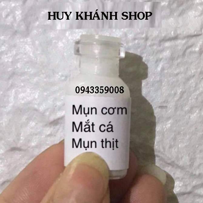 XOA NOT RUOI, TAN NHANG , MUN COC, MUN THIT