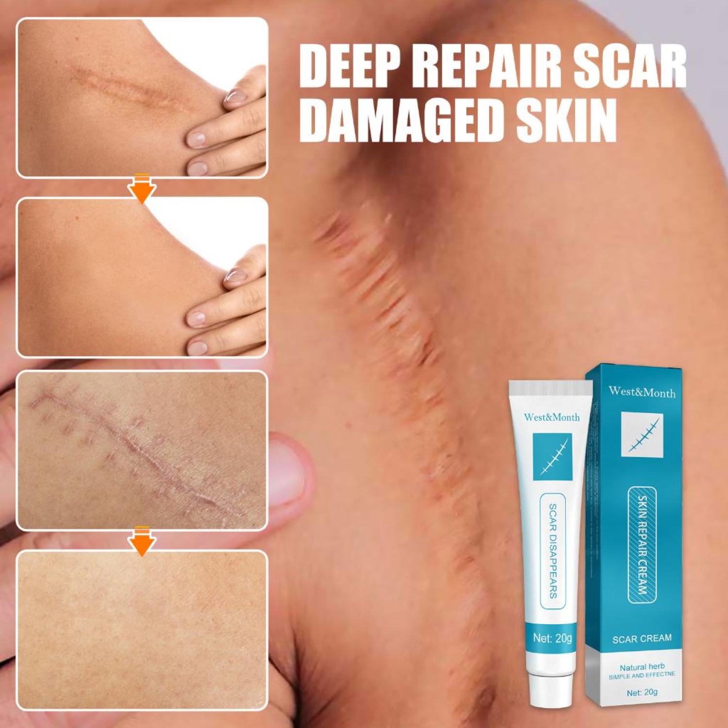 Kem tɾị Sẹo Scar Cream 20g