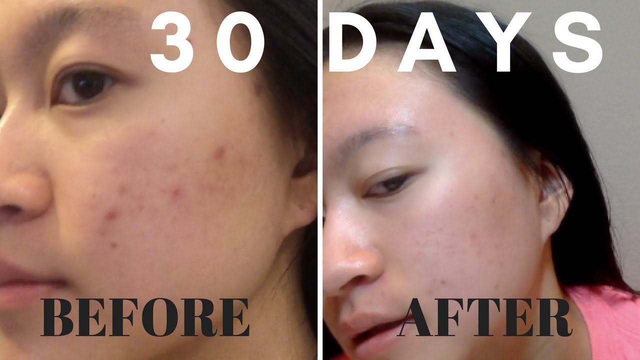 Mặt nạ đất sét Aztec Secret Healing Clay
