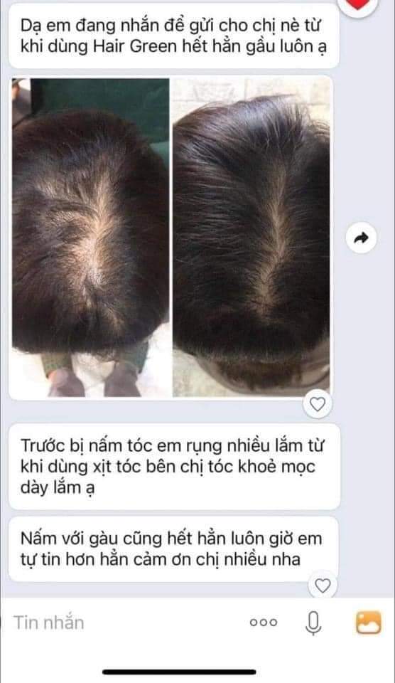Xỉ 10 lọ xịt tóc quyên lara