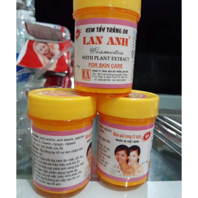 Kem Lan Anh Tẩy Trắng Da 80g