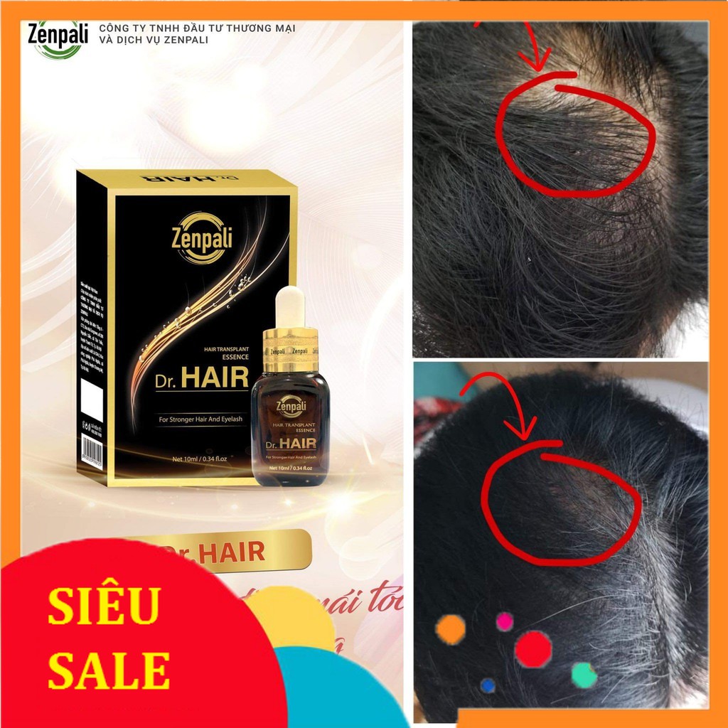 Tinh Chất Cấy Tóc Dr Hair Kích Thích Mọc Tóc , Lông Mày , Lông Mi Dài Nhanh