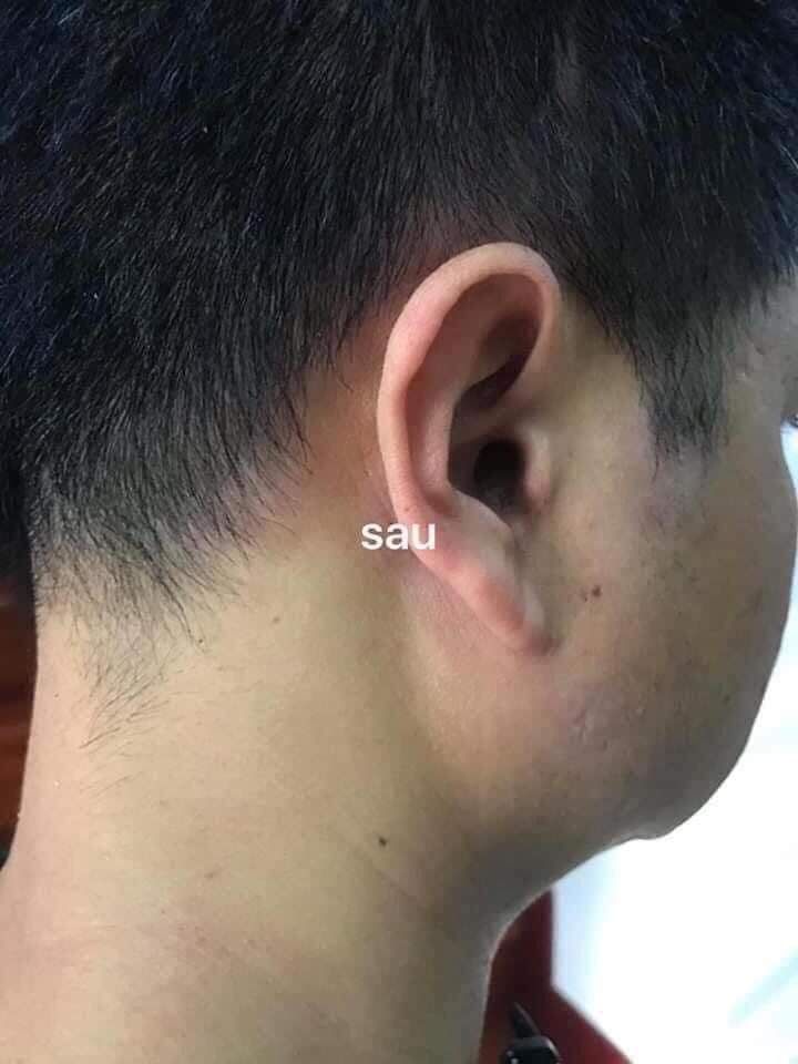 Kem bôi nấm, hắc lào... hiệu quả