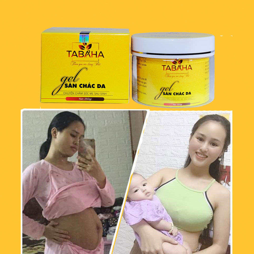 [HCM][Gel săn chắc da] Kem tan mỡ Tabaha 250g chăm sóc mẹ sau sinh giảm mỡ sau 1 tuần
