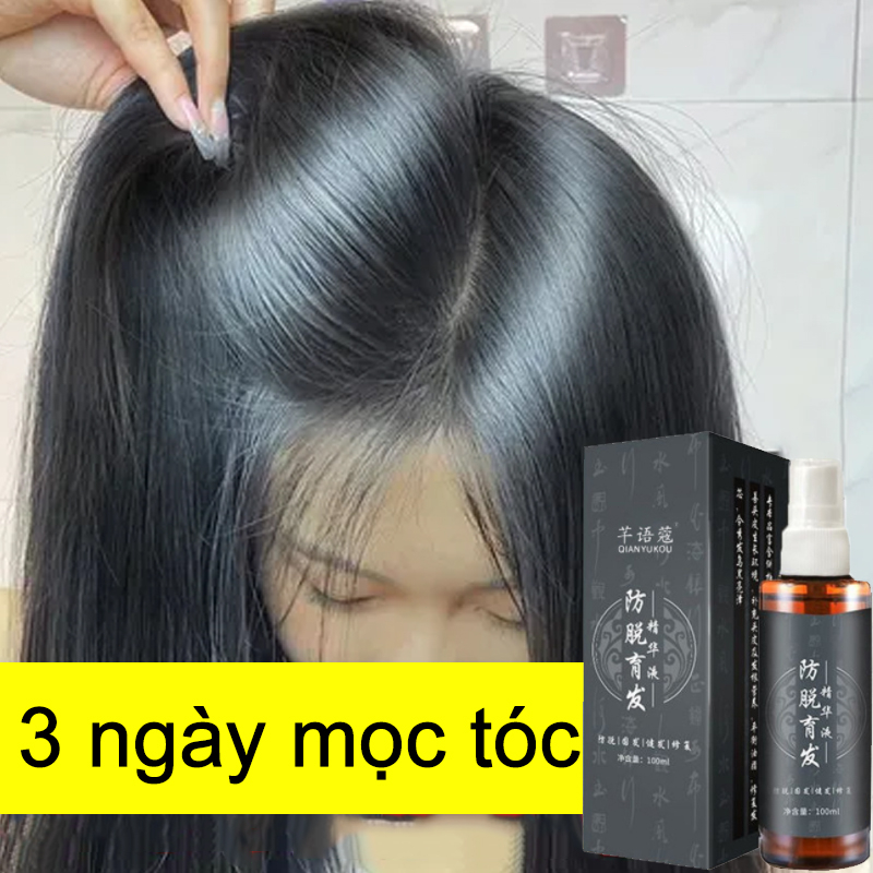 Tinh Dầu Xịt Kích Thích Mọc Tóc Nhanh Chóng Chống Rụng Tóc Cho Nam Và Nữ 100mlTinh chất mọc tóc tinh dầu mọc tóc 100ml serum kích mọc tóc chăm sóc tóc chống rụng tóc,kích thích tóc mọc dà