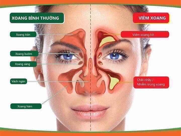 Ống hít xoang mũi Thái Lan