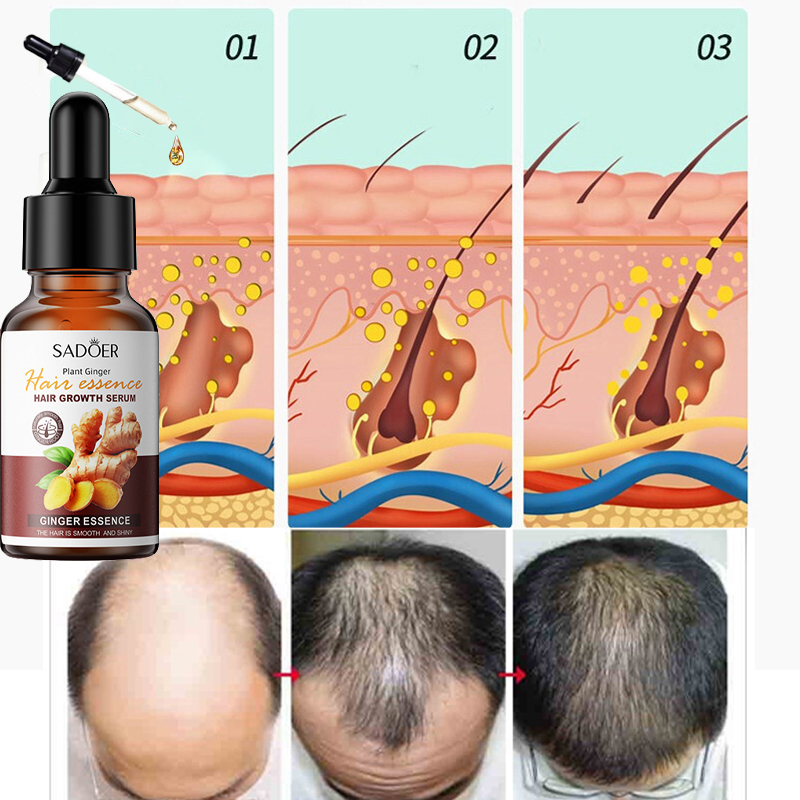 Thuốc mọc tóc serum kích mọc tóc chống rụng tóc kích mọc tóc chăm sóc tóc 30ml  kích thích mọc tóc nhanh làm dày