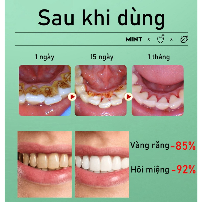 Kem đánh răng kháng khuẩn hương bạc hà sảng khoái, làm sạch sâu răng, khử mùi hôi miệng và làm trắng răng