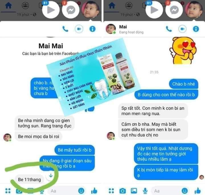 sâu răng nhật dương mẫu mới nhất
