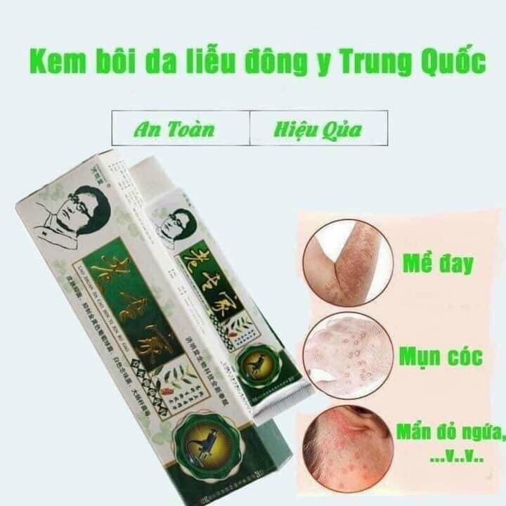 kem bôi nấm, hắc lào, lang ben