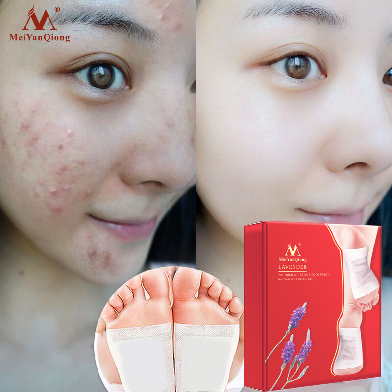 MeiYanQiong 10 Pieces/Box Miếng dán chân giải độc hoa oải hương Miếng Dán Sửa Chữa nuôi dưỡng Miếng dán chân cải thiện chất lượng giấc ngủ Miếng Dán Giảm Cân chăm sóc cân