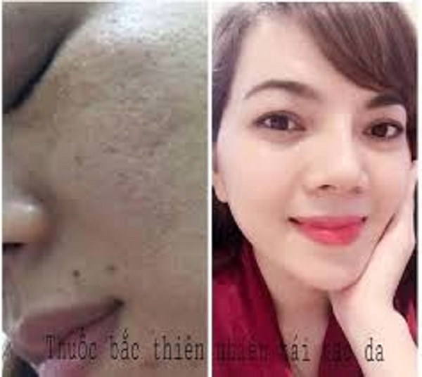 THAY DA TÁI TẠO ANGEl 50ML