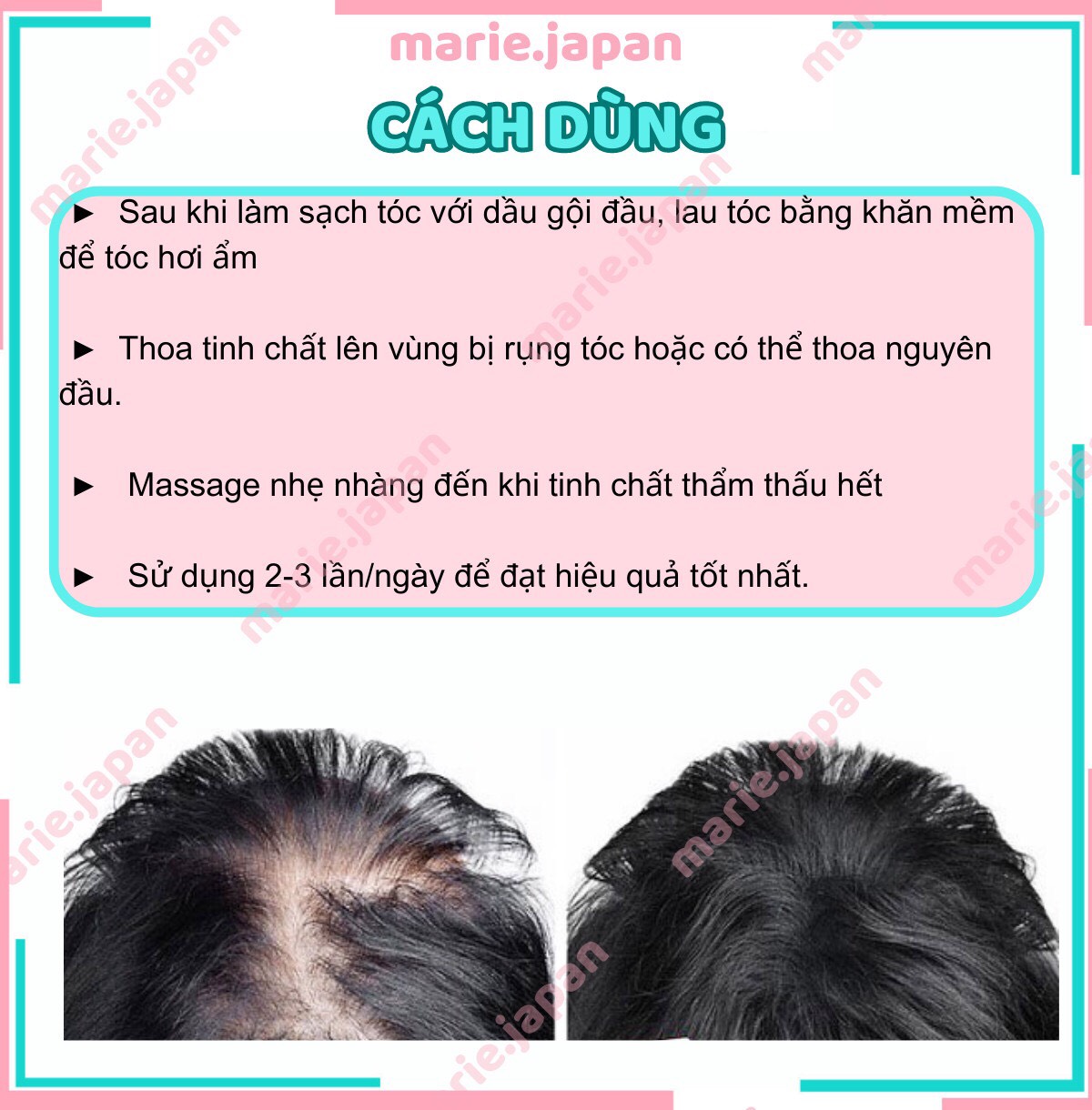 [Name Concealment] Sato Hair Growth Essence to Prevent Hair Loss 30ml Japan