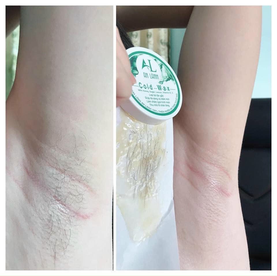Combo Wax Lông An Lành Và Mỡ Trăn An Lành 10ML ( Tặng kèm phụ kiện Wax )