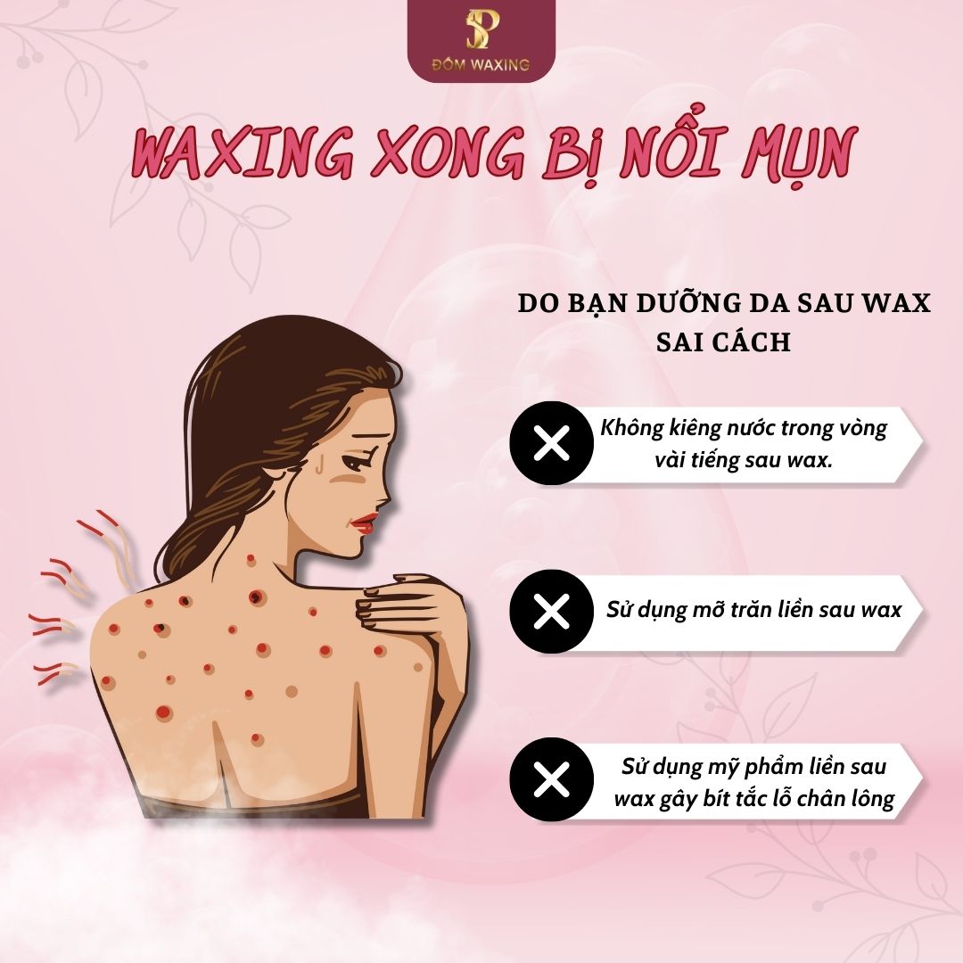 50ml Mỡ Trăn Nguyên Chất Triệt Lông Date Mới Nhất