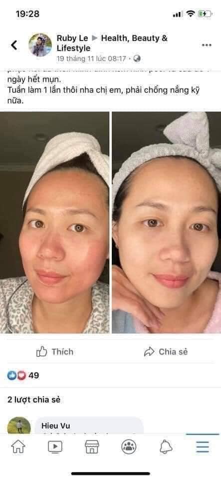 [ Bill hãng ] Thanh tẩy da AHA 30% + BHA 2% Peeling Solution - The Ordinary