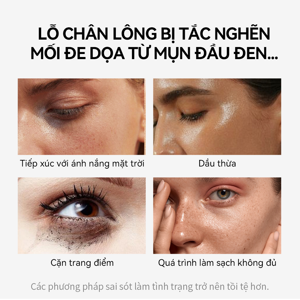 Miếng dán lột mụn mũi LANBENA 30g chăm sóc da hiệu quả