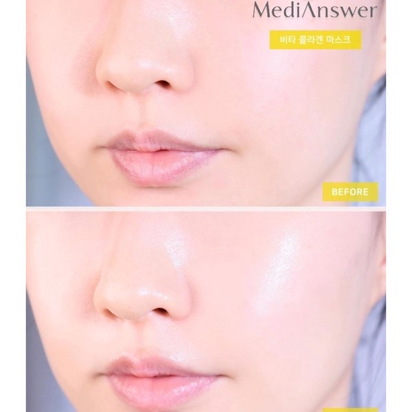 Mặt Nạ Thạch Collagen Medianswer Collagen Mask