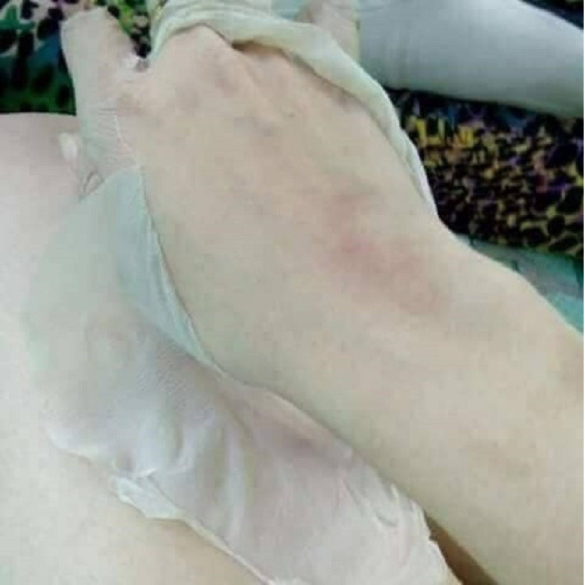 Lột Thay Da Collagen Thái Lan