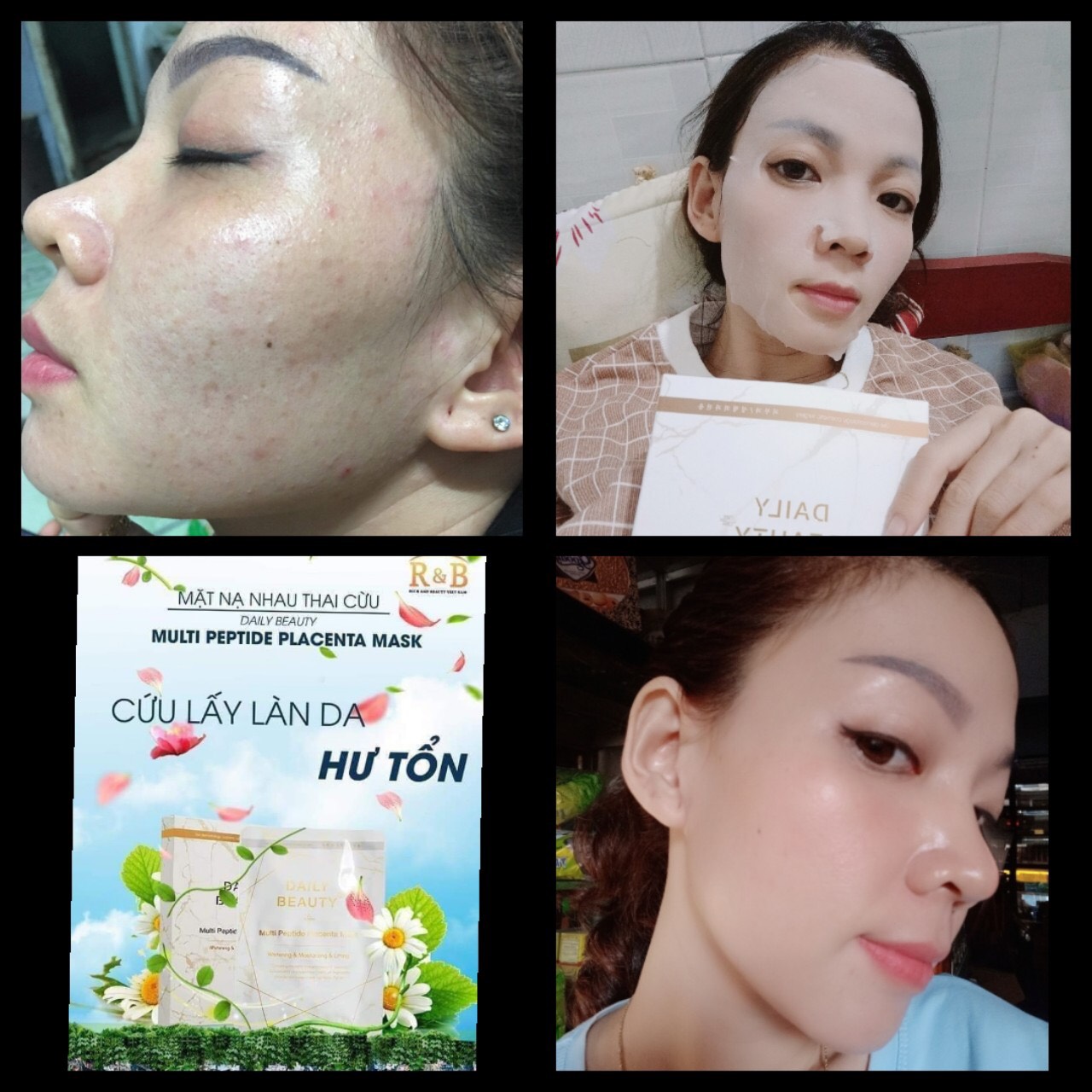 Mặt nạ nhau thai cừu hàn quốc
