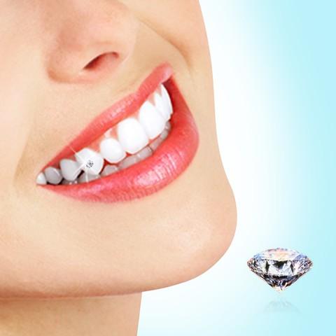 [HCM]hạt đính đá trên răng bộ 5 hạt + keo